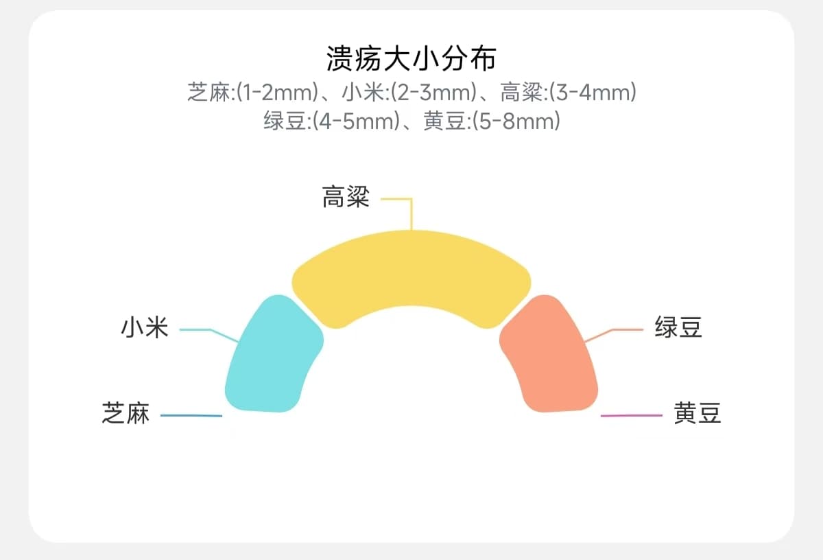 溃疡大小分布